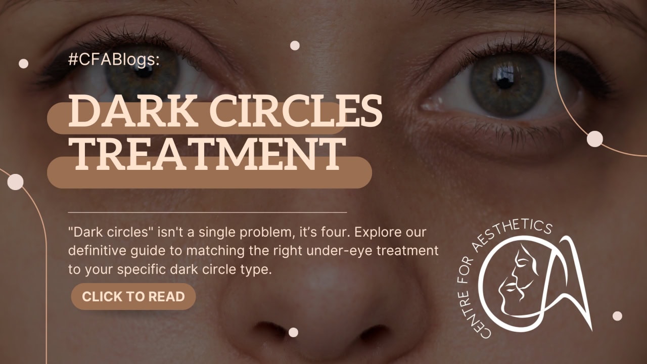 Dark Circles Under Eye Treatment